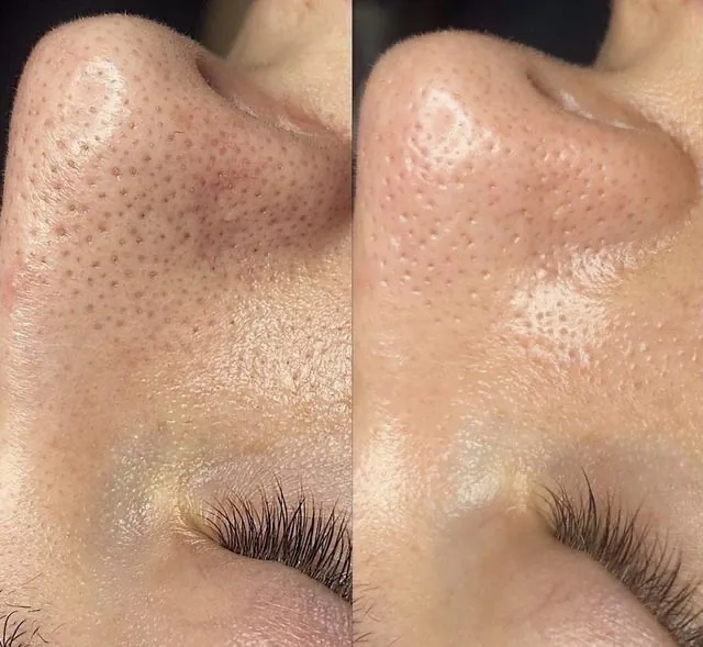 Kosmetik Einblick 19 – Kosmetik bei Beautyrella Berlin