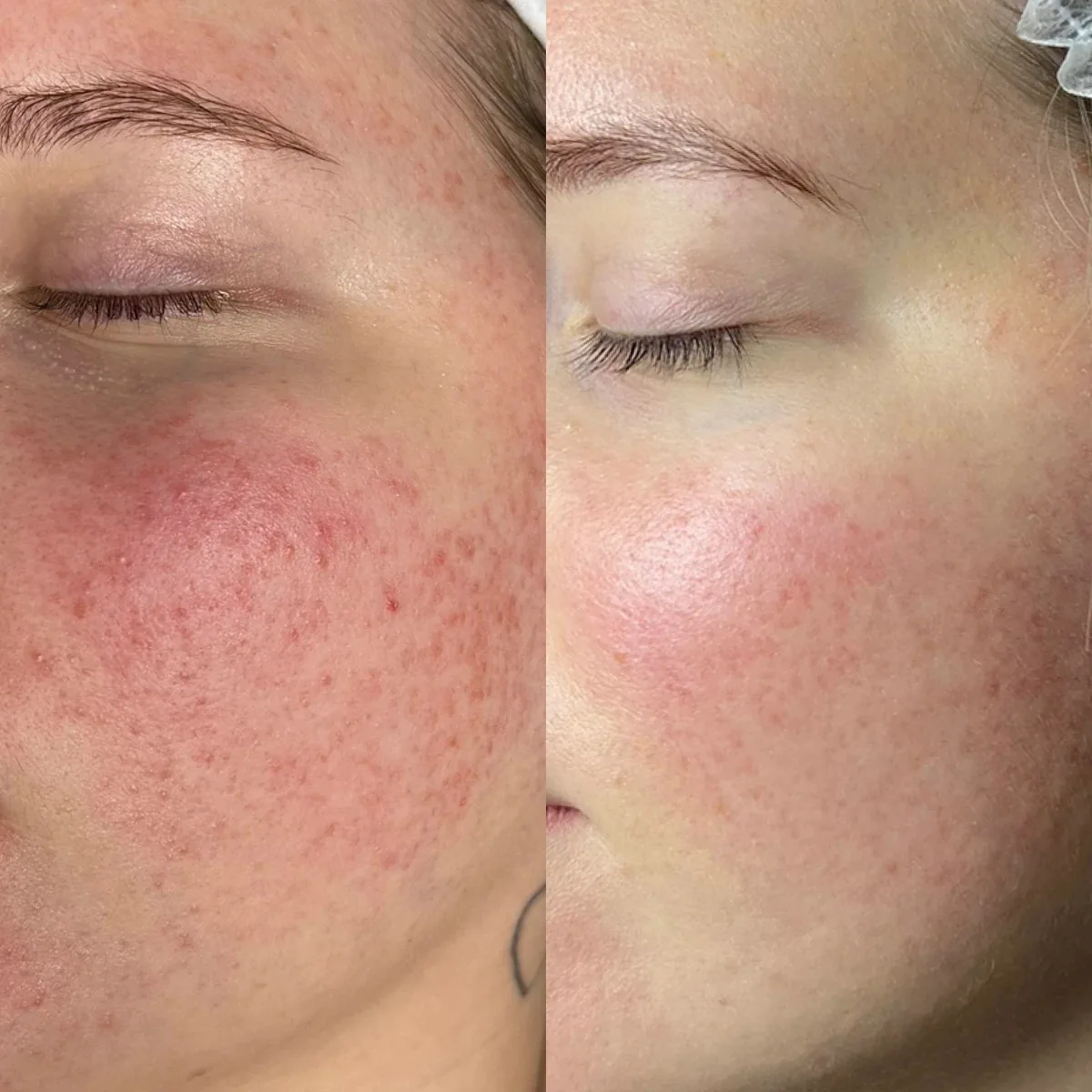 Kosmetik Einblick 26 – Kosmetik bei Beautyrella Berlin